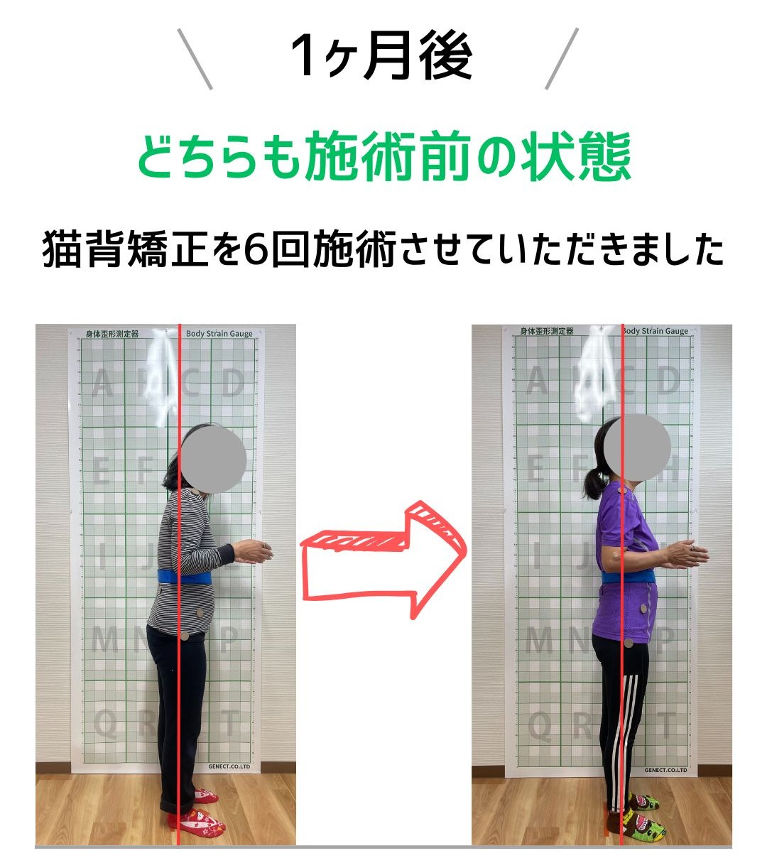 姿勢に変化　１ヶ月後どうなった？Before After
