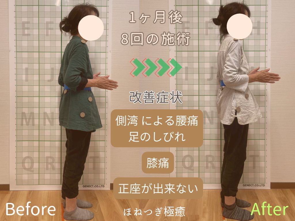 腰痛、膝痛、足の痺れ、側湾症で悩む女性の施術