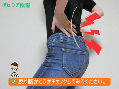 反り腰で悩む女性