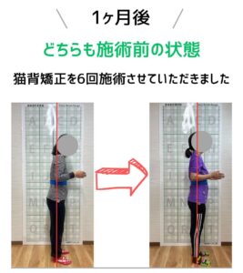 姿勢に変化　１ヶ月後どうなった？Before After