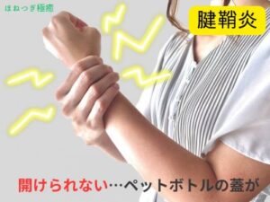 腱鞘炎で悩む方への解決法