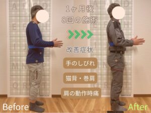 手の痺れと肩の痛みで悩む５０代男性
