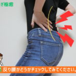 反り腰で悩む女性