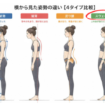 猫背・巻き肩・反り腰で悩む女性