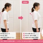 姿勢改善のビフォーアフター比較。30代女性の猫背・巻き肩が改善し、頭痛や背中の痛みが軽減した様子