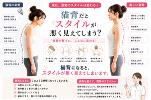 猫背と美しい姿勢を横から比較し、猫背ではバストが下がって見えたりお腹がぽっこり見えたりする姿勢の違いを解説した画像